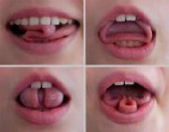 preview of Tongue Disfiguring.jpg